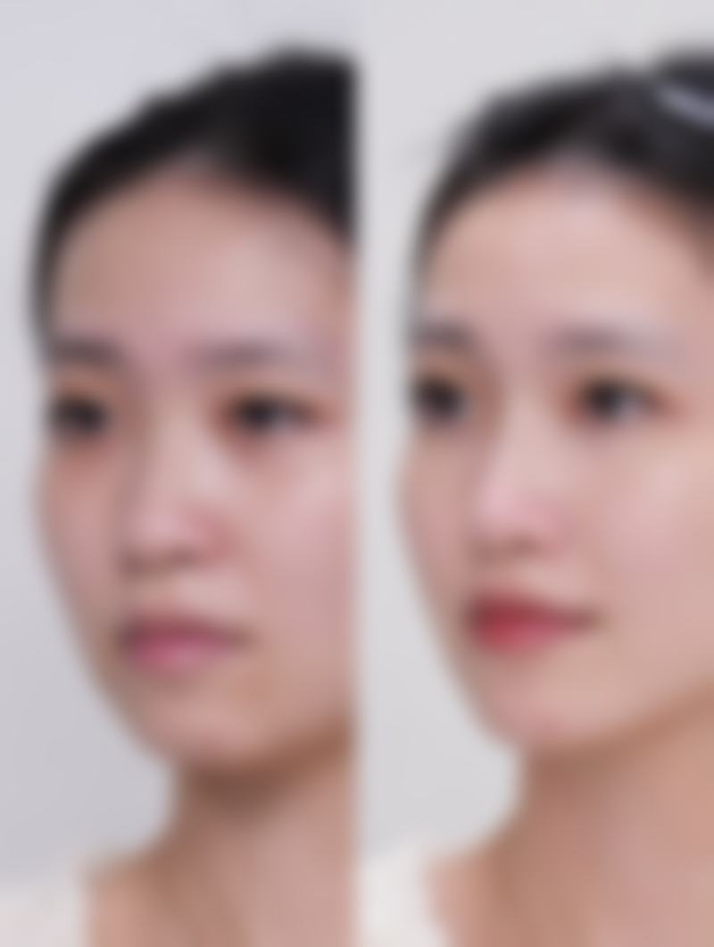 青岛驻颜科技有限公司市南医疗美容诊所临床典型服务范例