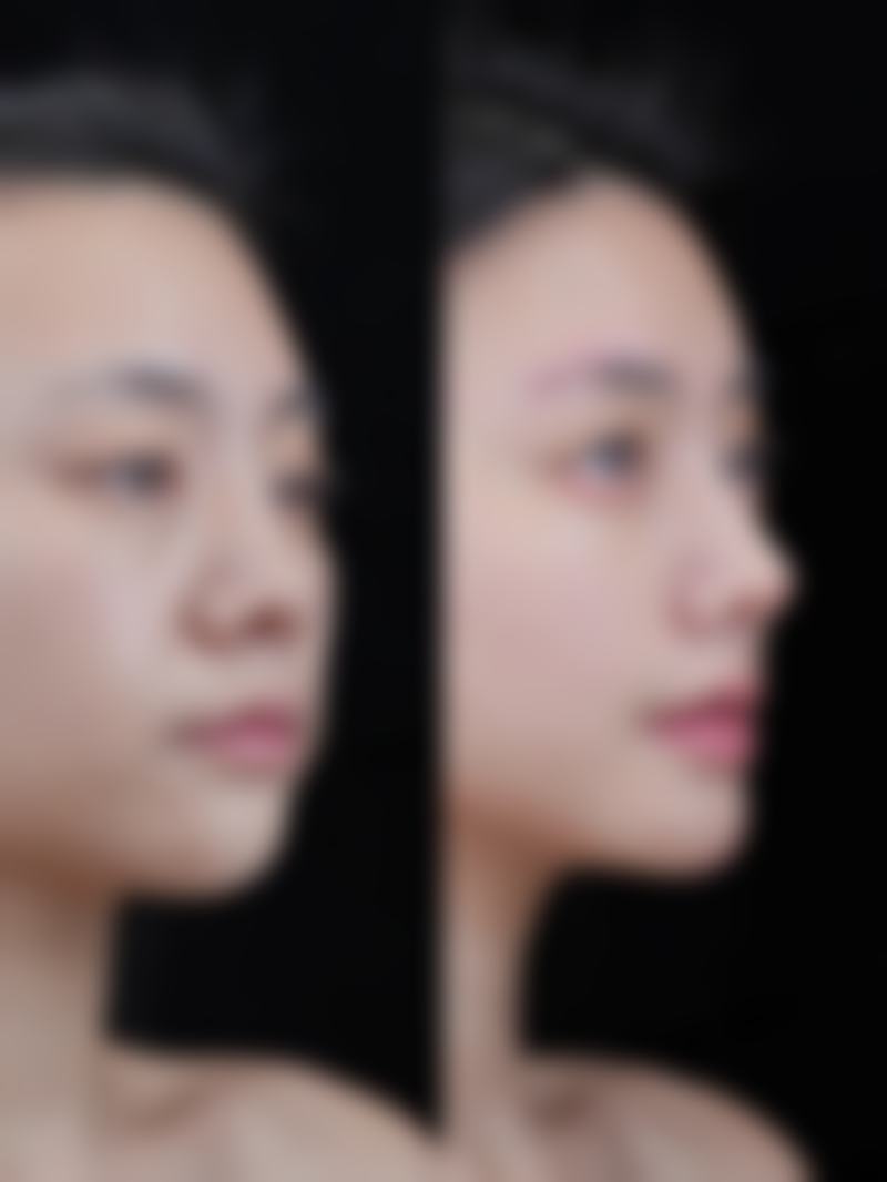 吕仁荣擅长项目列表