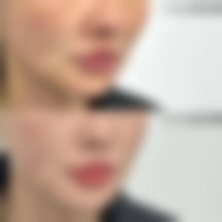 合肥仁德医院整形美容科项目价格参考