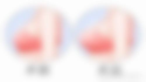 高安阅美整形医院临床典型服务范例