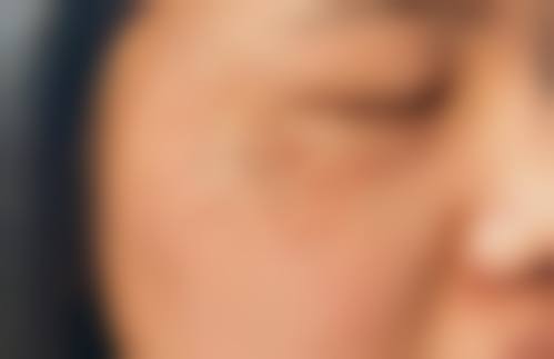武汉悦秀医疗美容门诊部擅长项目