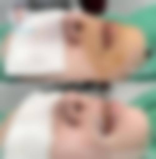瑞丽永龄整形医院擅长项目