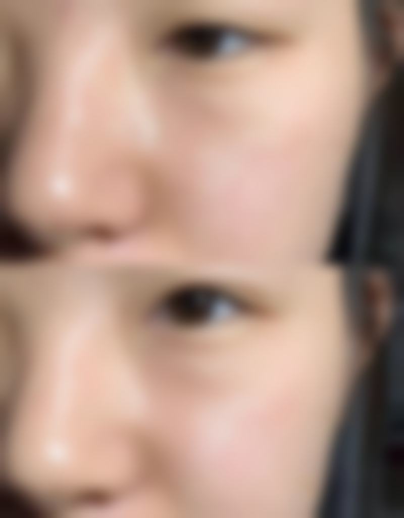 上海览海门诊部医疗美容中 心临床典型服务范例