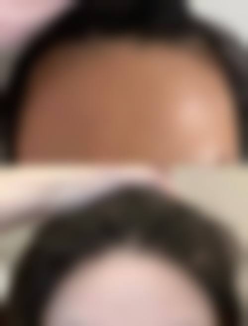 北京美尔目医院医疗美容科怎么预约挂号？