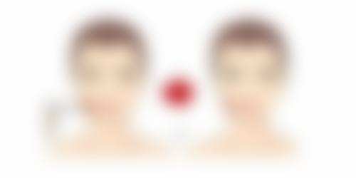 崔贤敏（ChoiHyun-min）患者评价