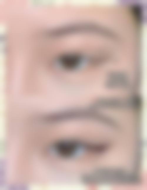 厦门欣颜时光医美临床典型服务范例