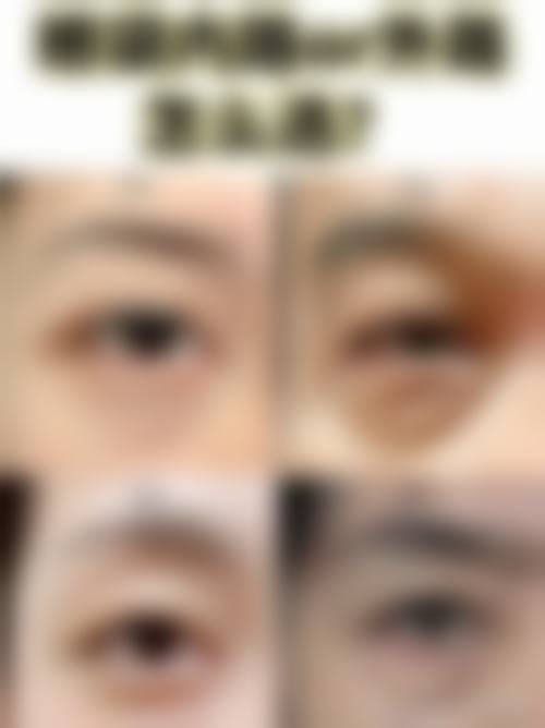 广州华晨壹美整形医院怎么预约挂号?