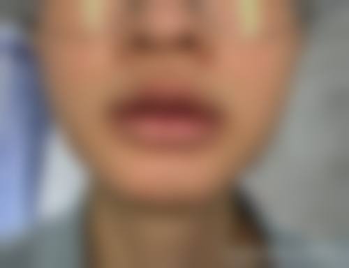 上海浦东新区摩尔齿科整形（塘桥总店）怎么预约挂号？