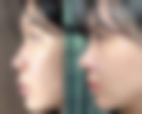 广州尚美善造整形美容门诊项目价格参考
