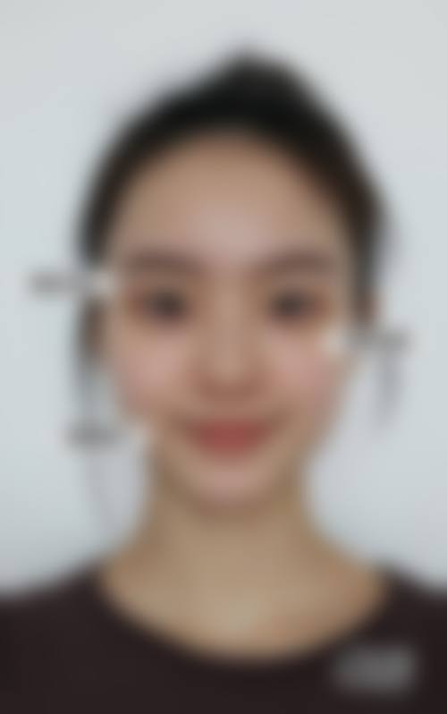 烟台壹美医疗美容医院擅长项目