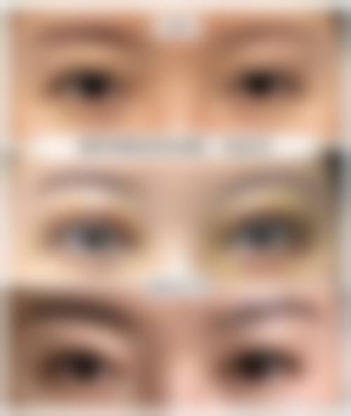 烟台壹美医疗美容医院项目价格参考