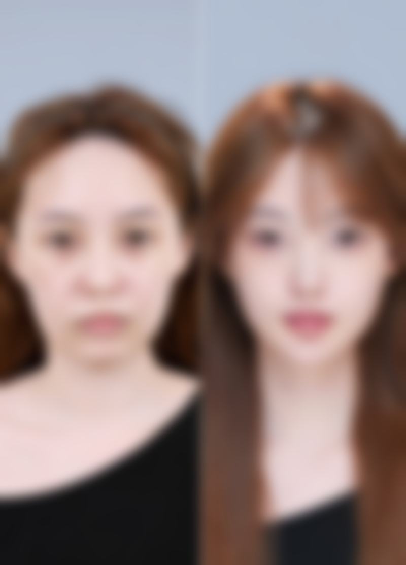 铜陵周陈医疗美容诊所临床典型服务范例
