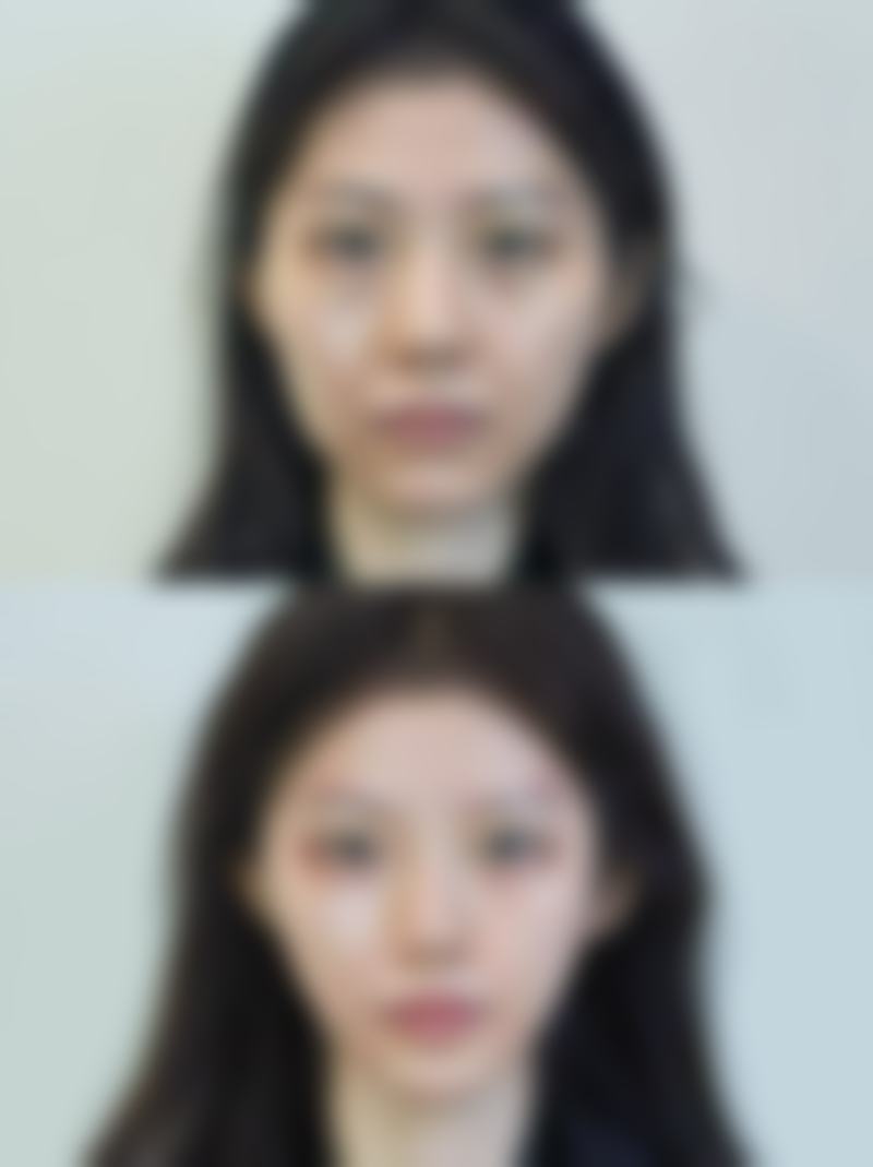 深圳格芮医疗美容门诊部项目价格参考