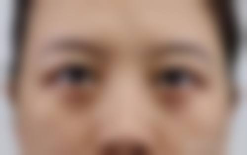 池州伊尚美整形医疗美容门诊部临床典型服务范例