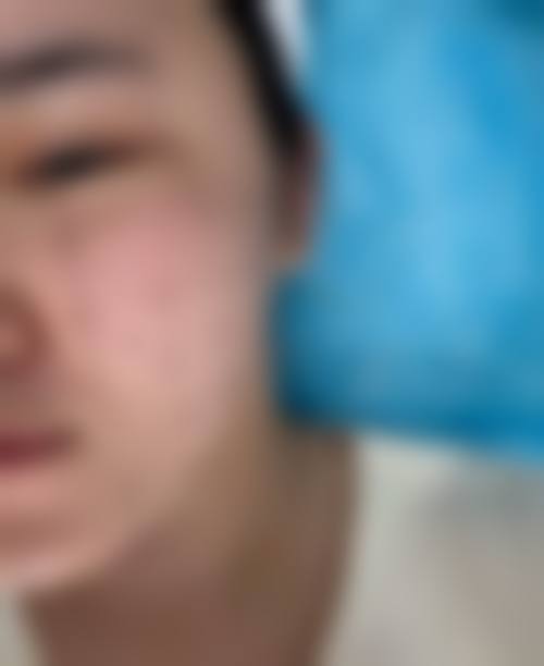 花都胡忠医院医学美容整形中 心擅长项目