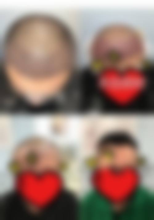 锦州医 科 大学附属第一医院(医学美容病区)怎么预约挂号?