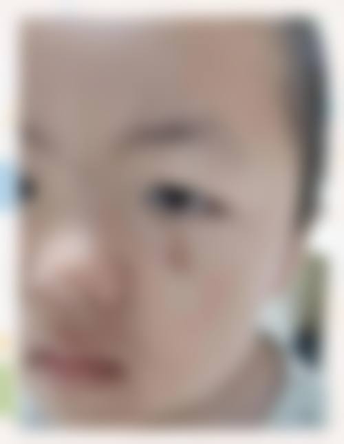 佛山幼肤医学美容项目价格参考