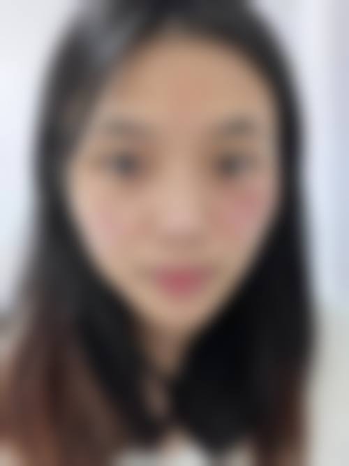 佛山幼肤医学美容临床典型服务范例