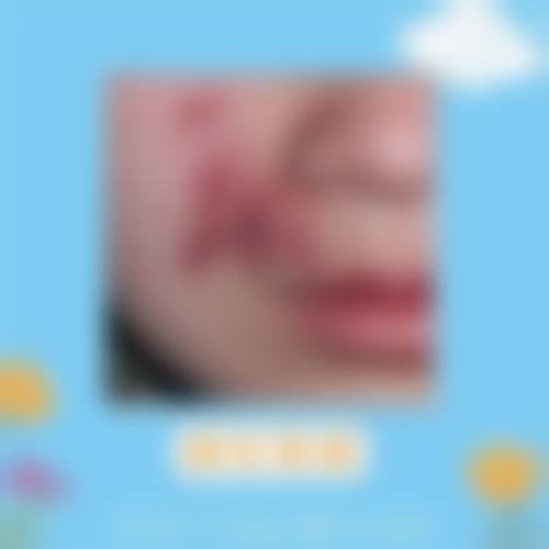 佛山幼肤医学美容擅长项目