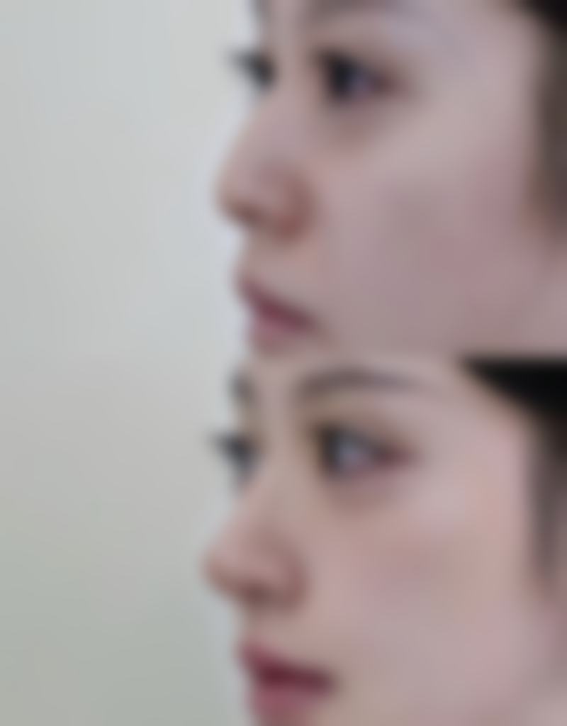 随州中 心医院医学美容科临床典型服务范例