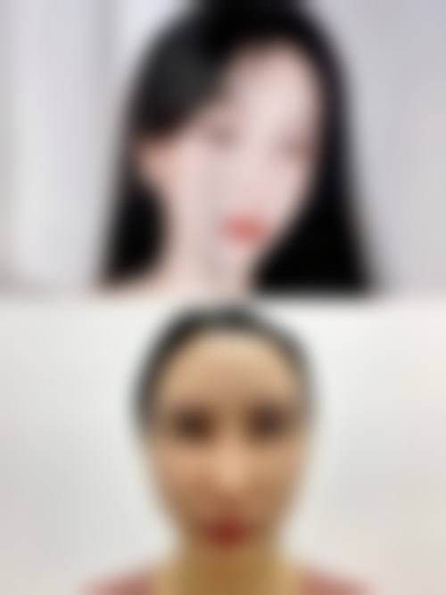 大连纤思韵整形医院临床典型服务范例