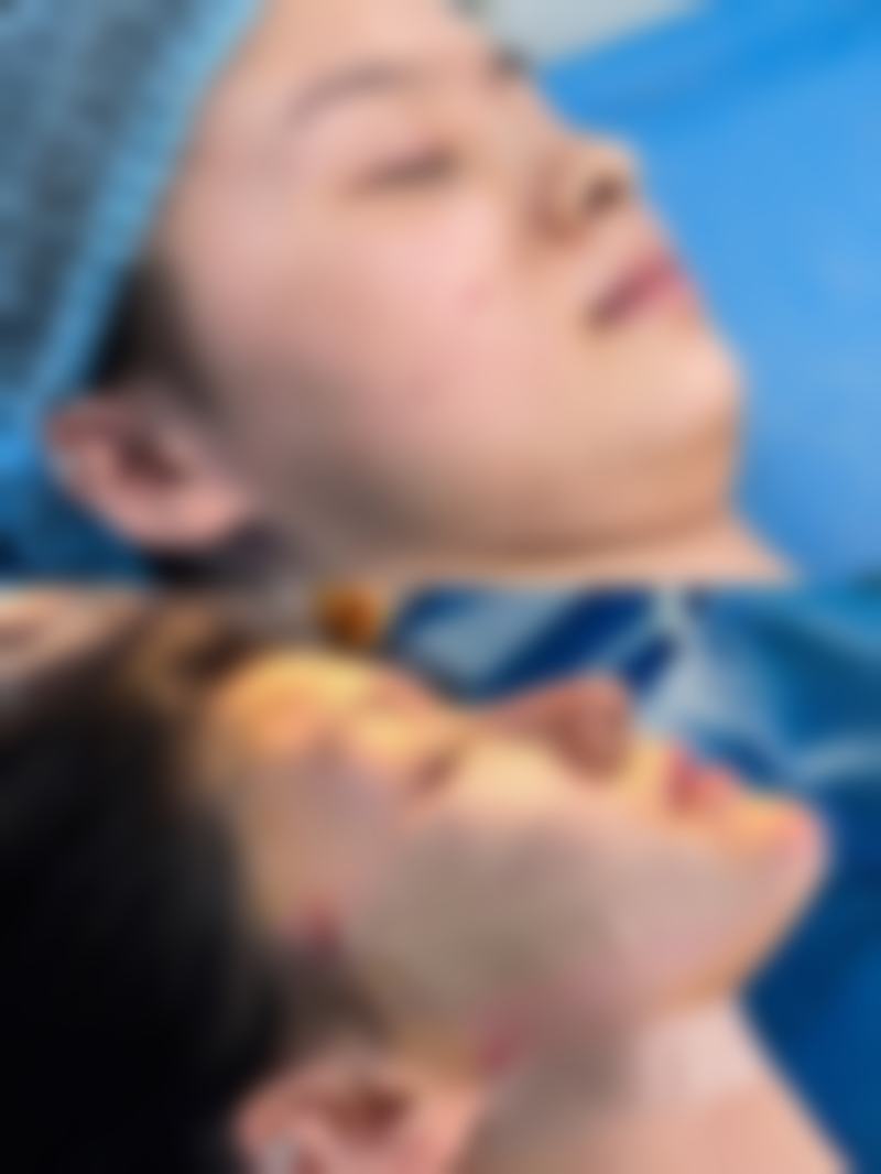 荆门市中医医院烧伤整形科擅长项目