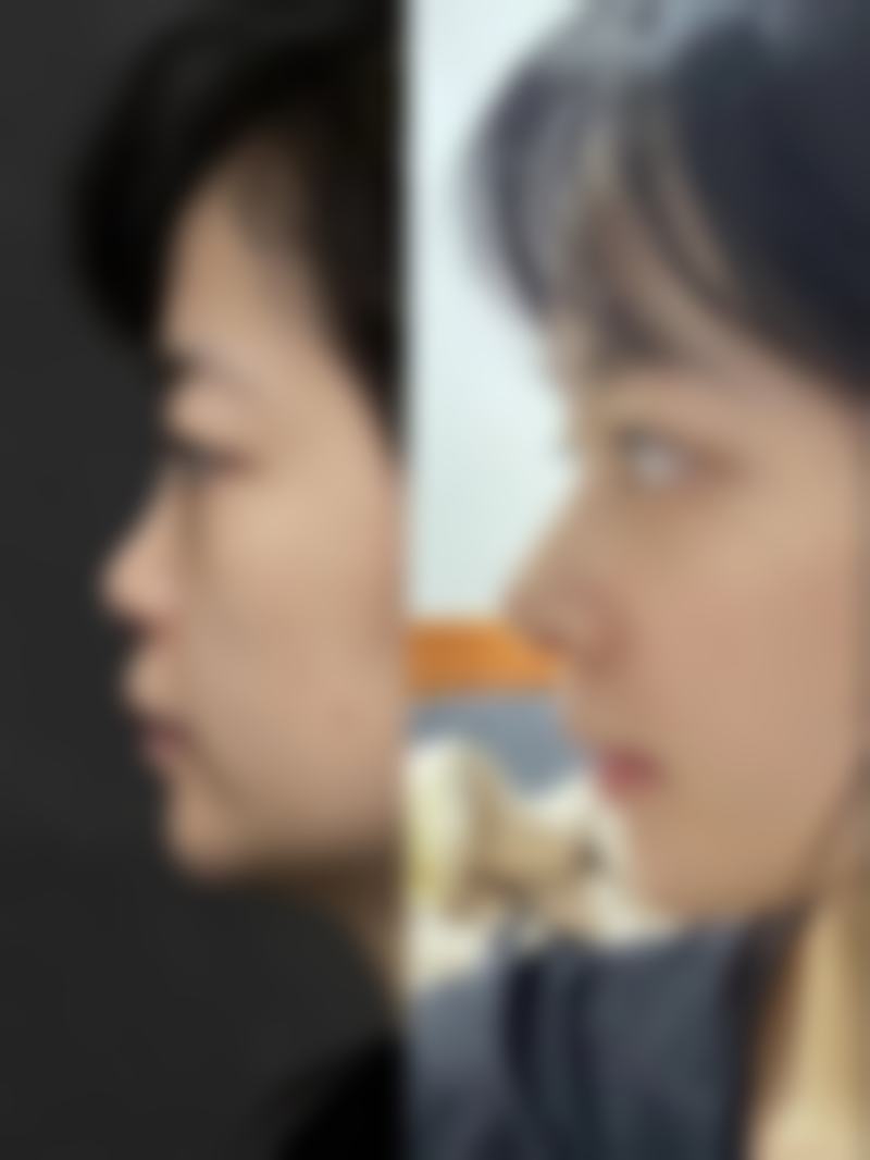 南昌雅美医疗整形医院擅长项目