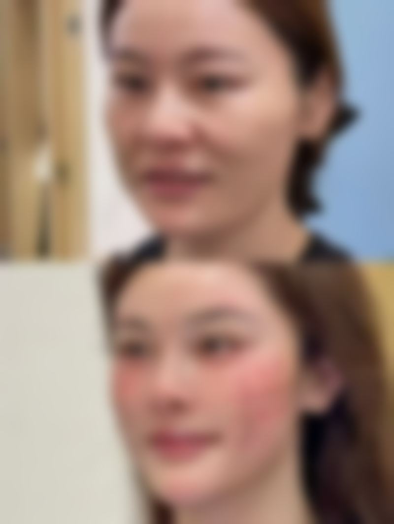 伍春华患者评价