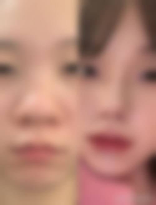 永州新唯美整形美容门诊部项目价格参考