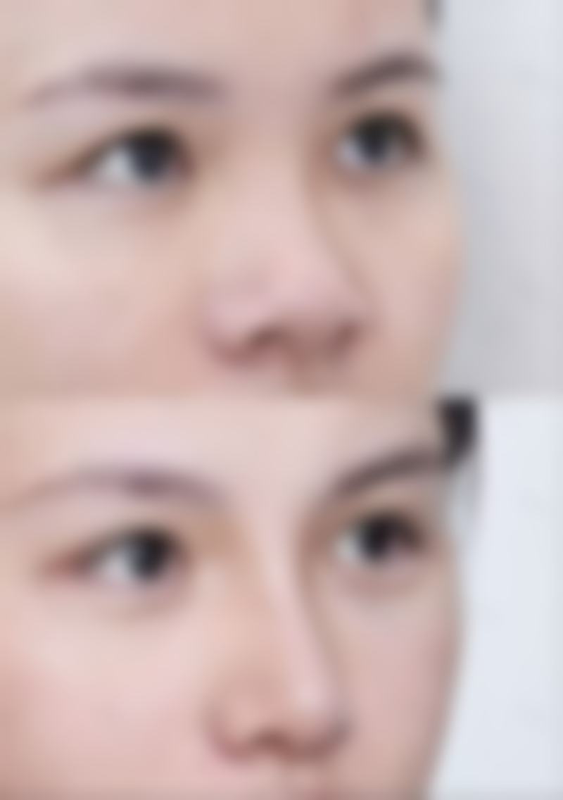郑小华患者评价