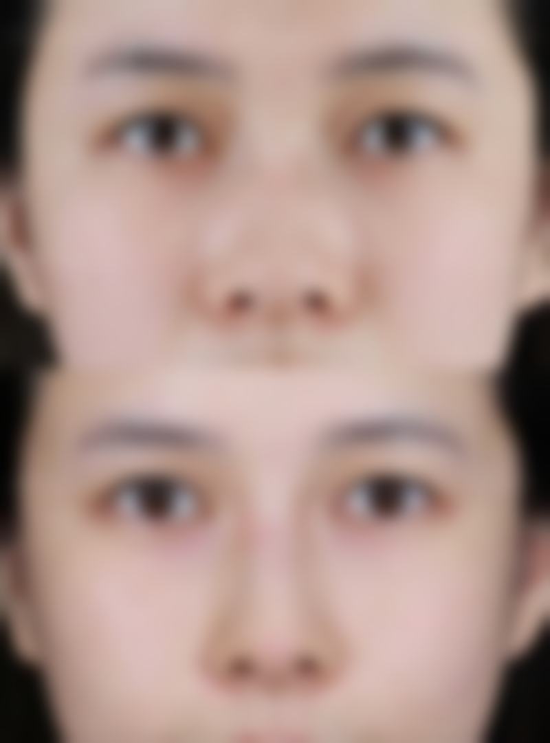 信阳奕美医疗美容门诊部怎么预约挂号?