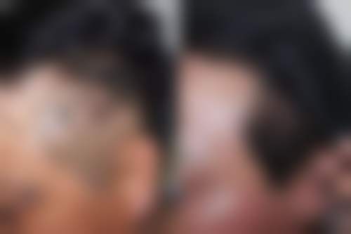 无锡DBC朵美整形医院擅长项目