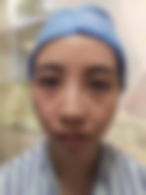 莒县人民医院整形美容治疗中 心擅长项目