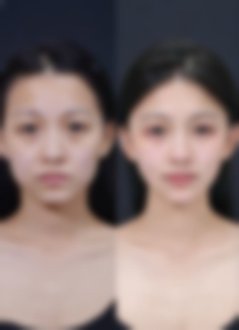 深圳博美医疗美容门诊部地址及到院路线