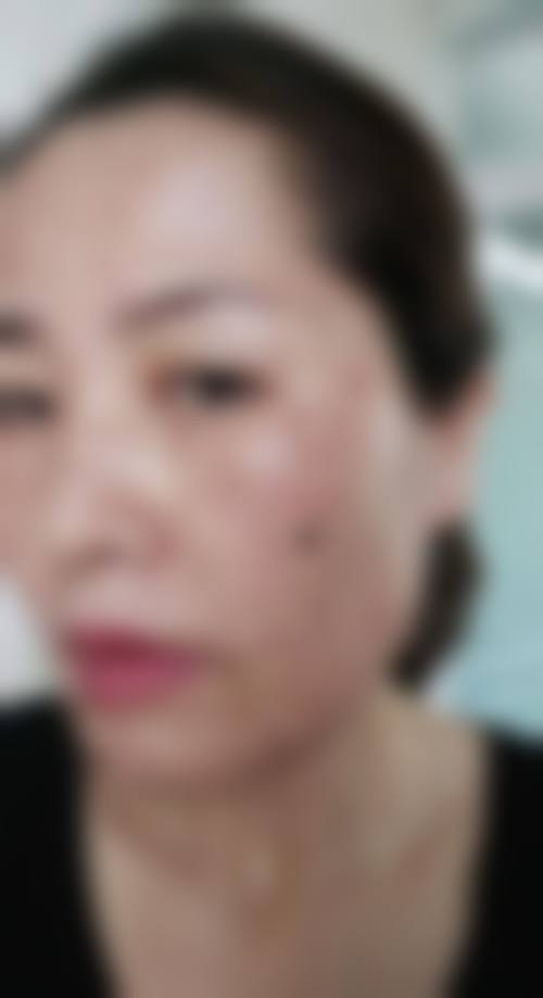 丽水市第二人民医院整形科项目价格参考