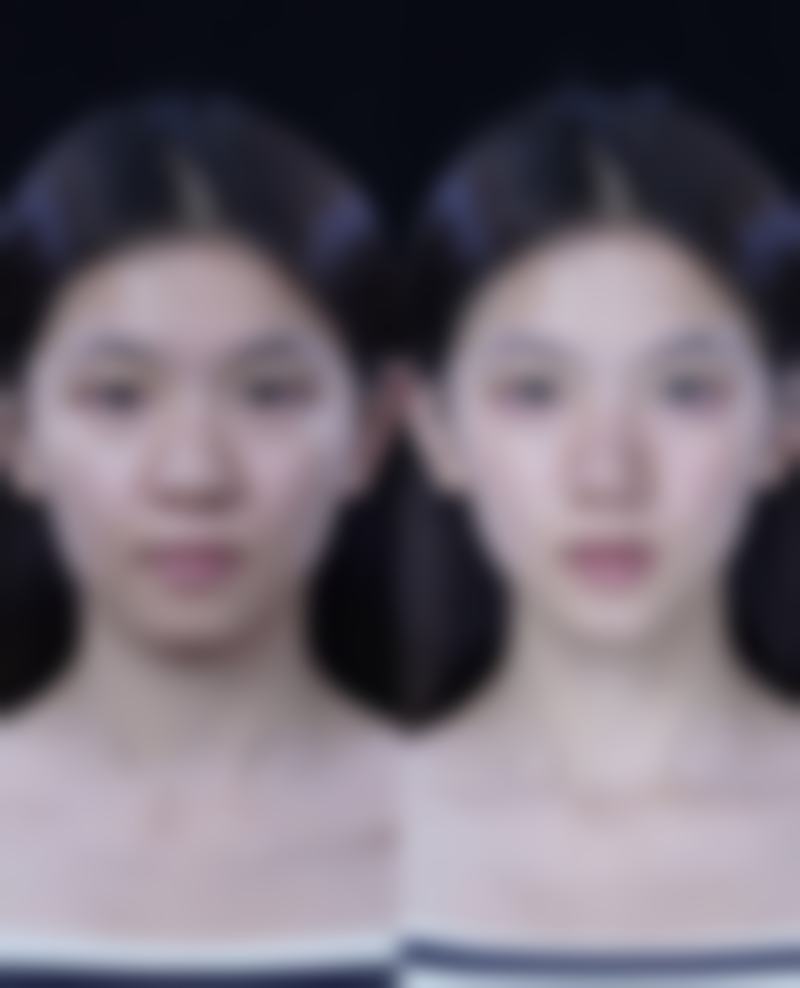 黄发患者评价
