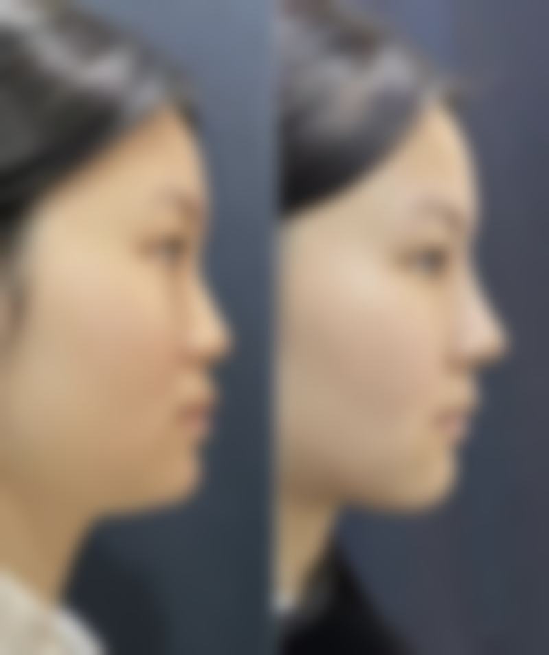 张新合患者评价