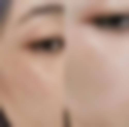 宁波尚美整形美容医院项目价格参考