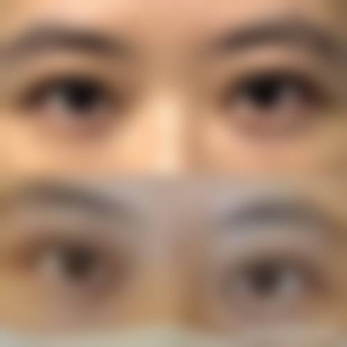 福州超美整形医疗美容门诊部擅长项目