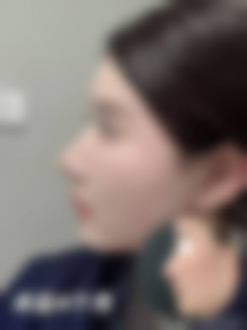大连爱普医疗美容诊所项目价格参考