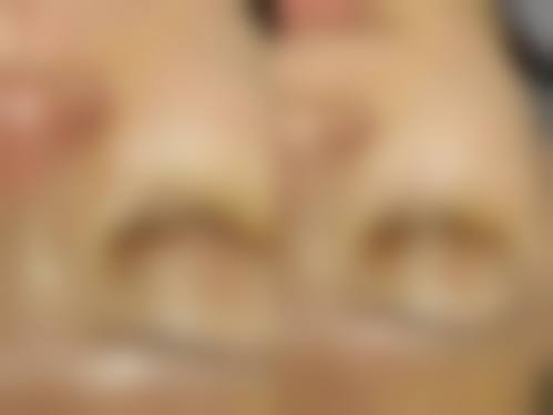 广州普罗菲医疗美容诊所临床典型服务范例