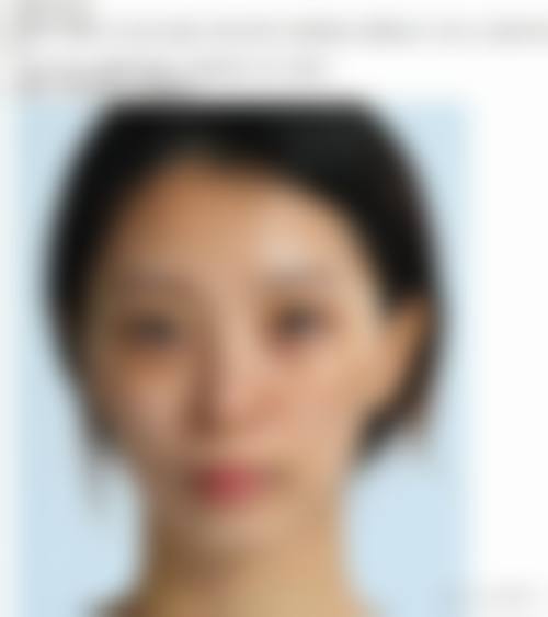 乌鲁木齐梵珞希洛颜整形医院擅长项目