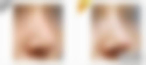 烟台美神诊所项目价格参考