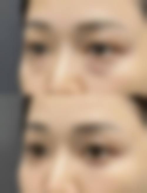 富锦金美梦瑶整形医院擅长项目