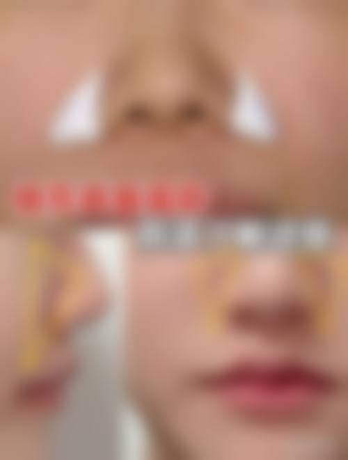 Q:优惠活动有效期多久?