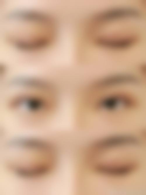 益阳德美整形医院擅长项目