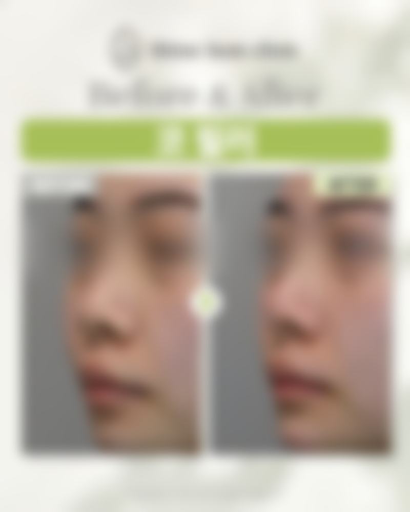 等待惊喜的日子