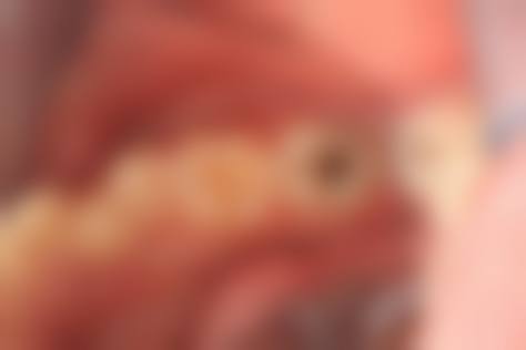 擅长项目详解