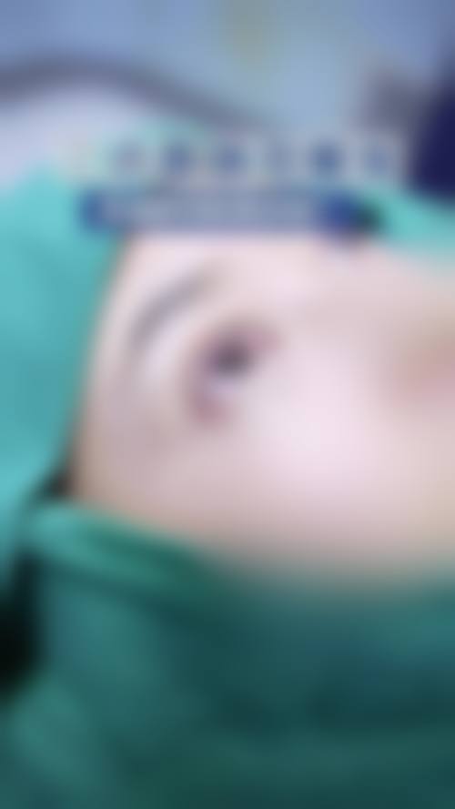 兰州美丽达整形医院临床典型服务范例