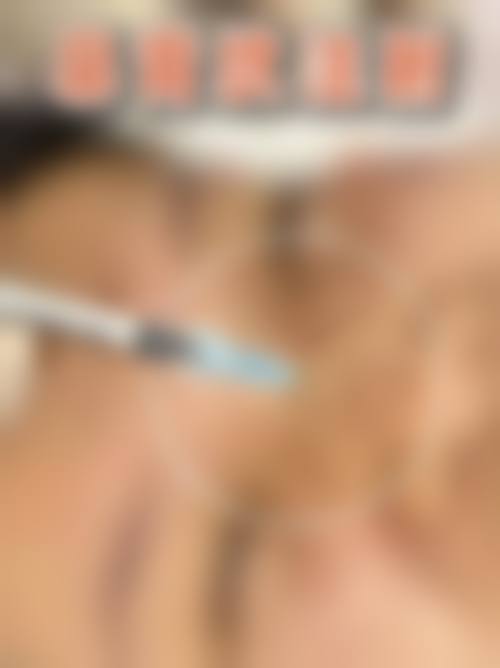 问:优惠活动有效期是多久?是否所有项目都参与?